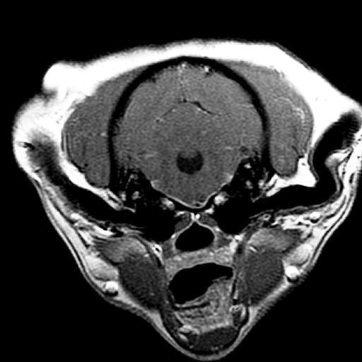 Axial T1 MRI contrast2